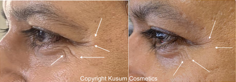 Stem Cell Cream
