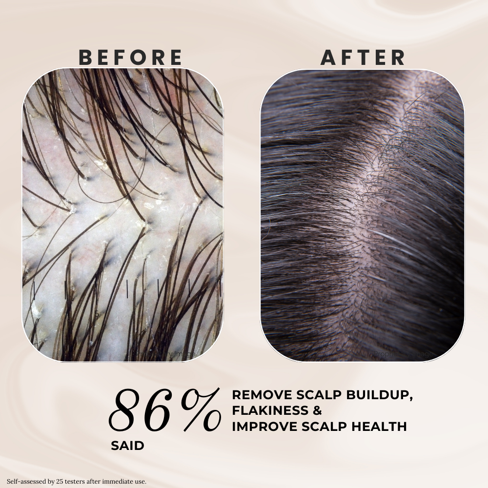 Multicare Scalp Mask